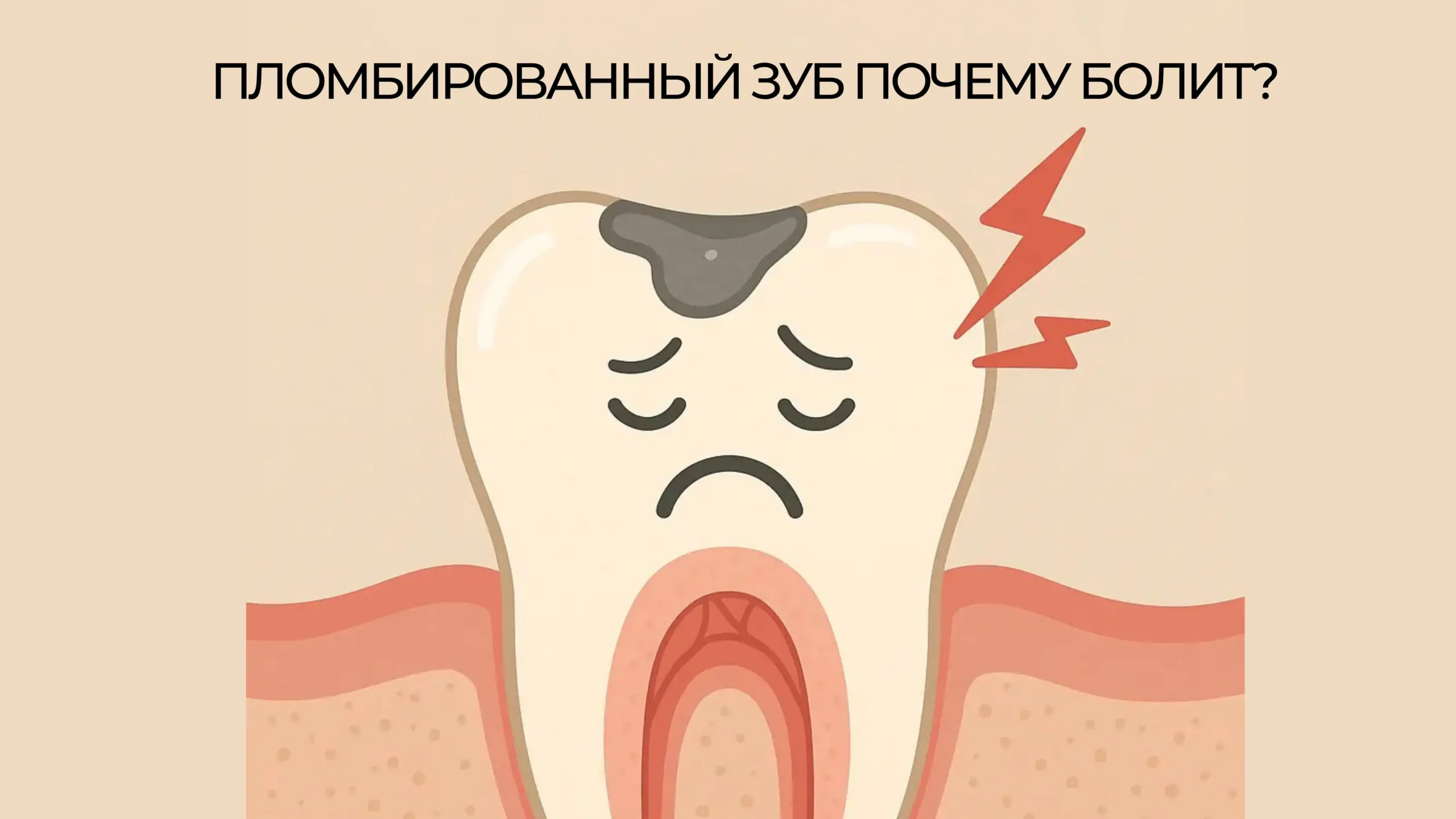Почему болит зуб после пломбы: причины и что делать
