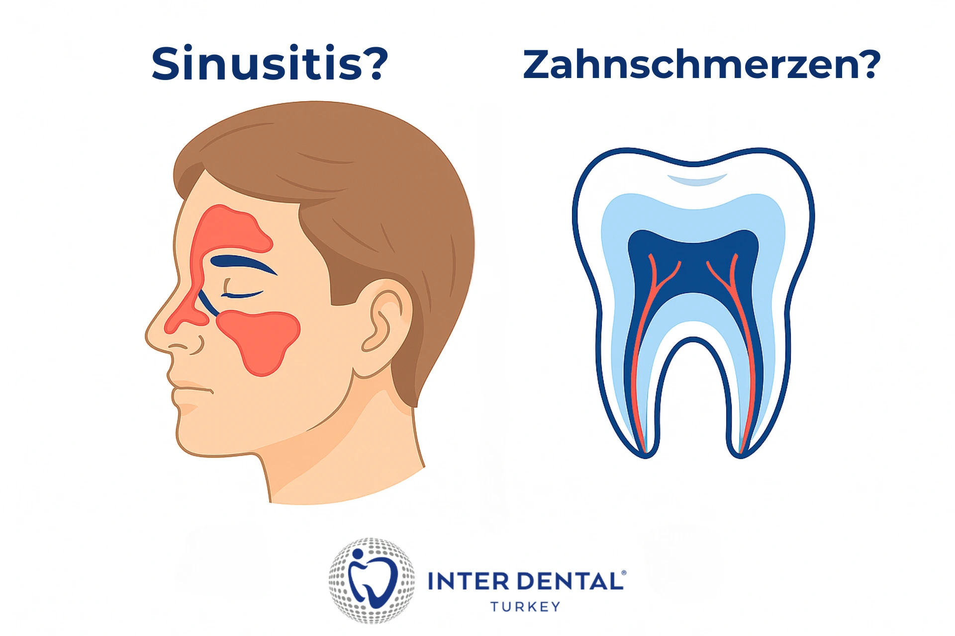 Sinusdruck vs. Zahnschmerz: Oberkiefer-Schmerz richtig einordnen