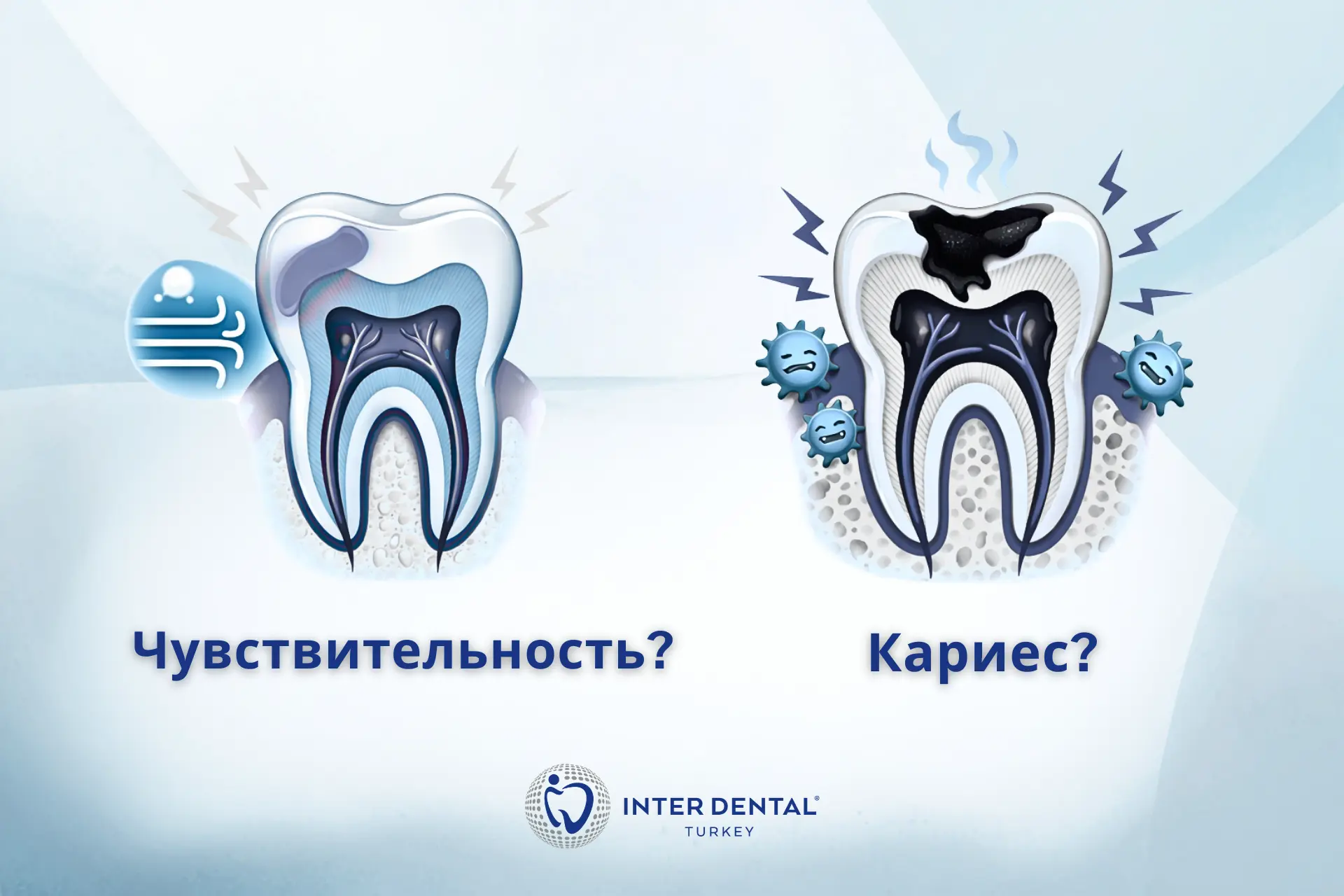 Как отличить чувствительный зуб от кариеса: реакция на холодное, сладкое, боль при накусывании и длительная боль