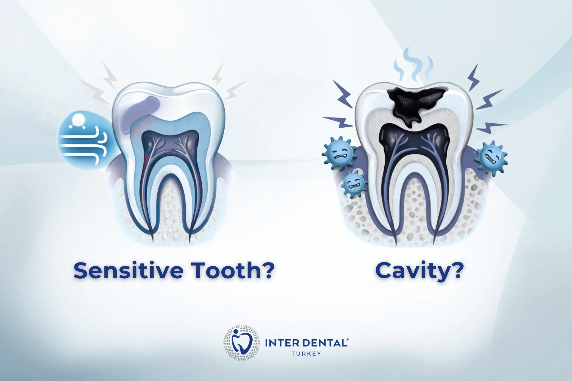 Ilustración que compara un diente sensible y una caries con diagramas internos del diente