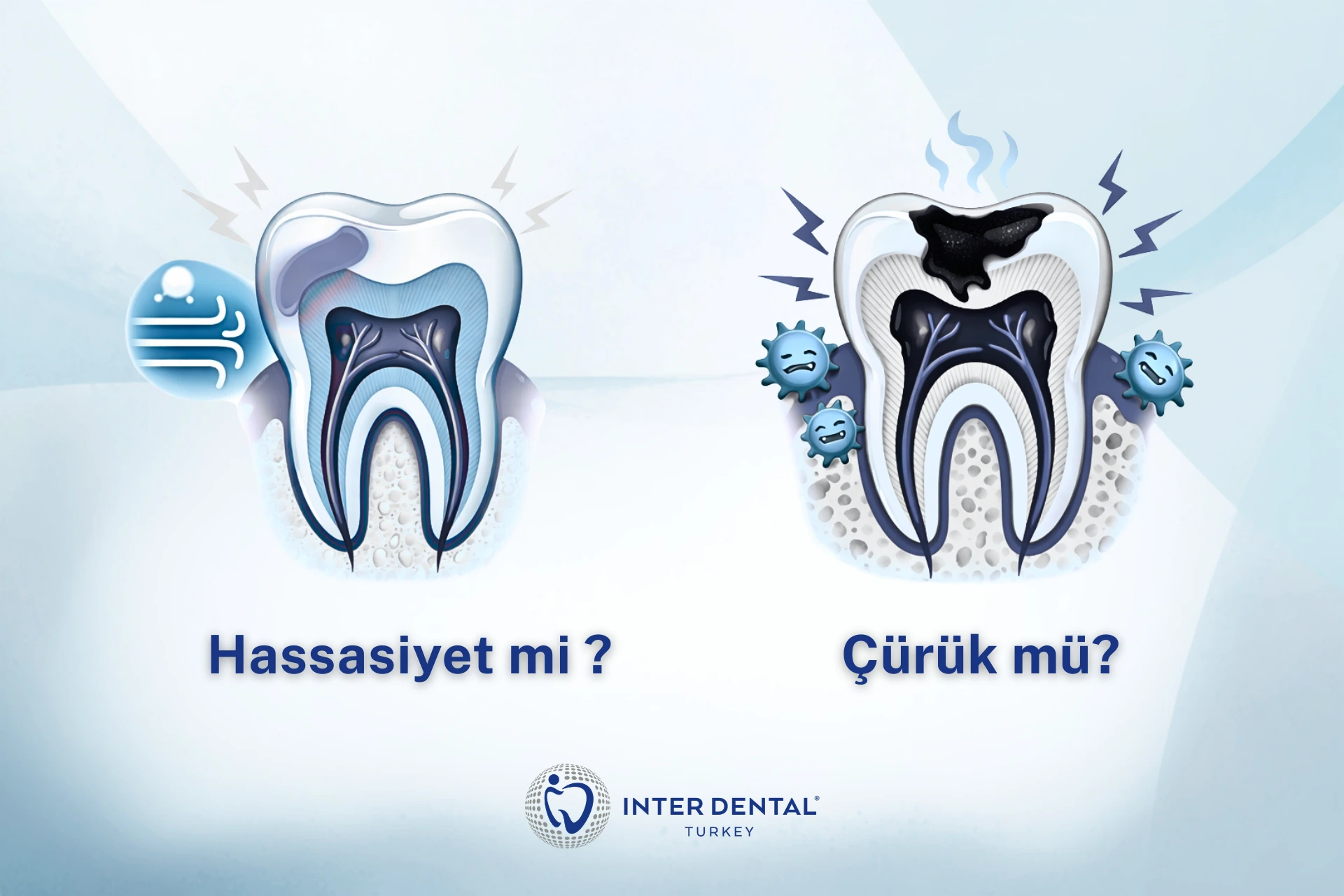 Diş hassasiyeti ile çürük belirtilerini karşılaştıran açıklayıcı görsel