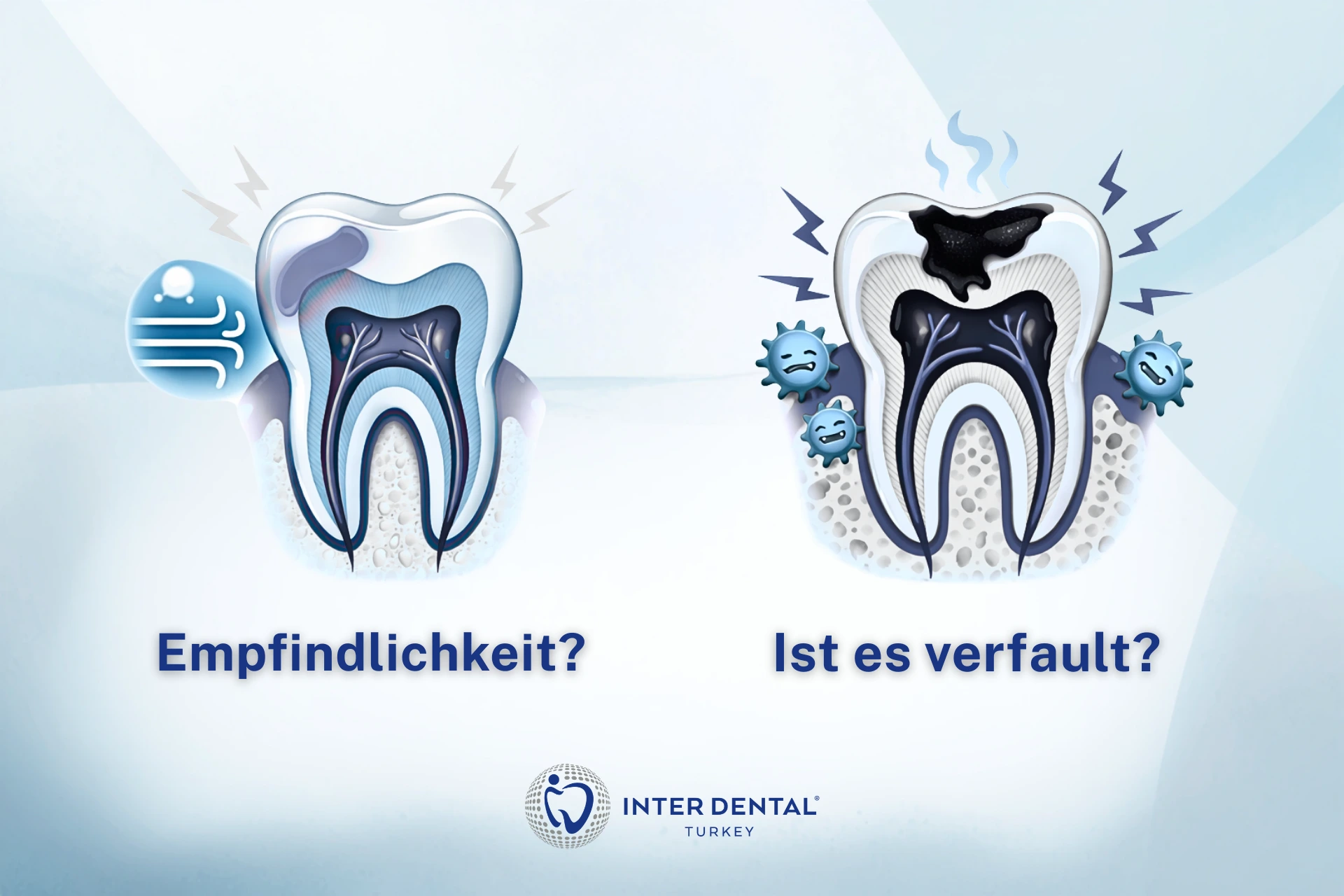 Empfindlicher Zahn oder Karies? Vergleich typischer Anzeichen wie Kälteempfindlichkeit und Schmerzen beim Kauen