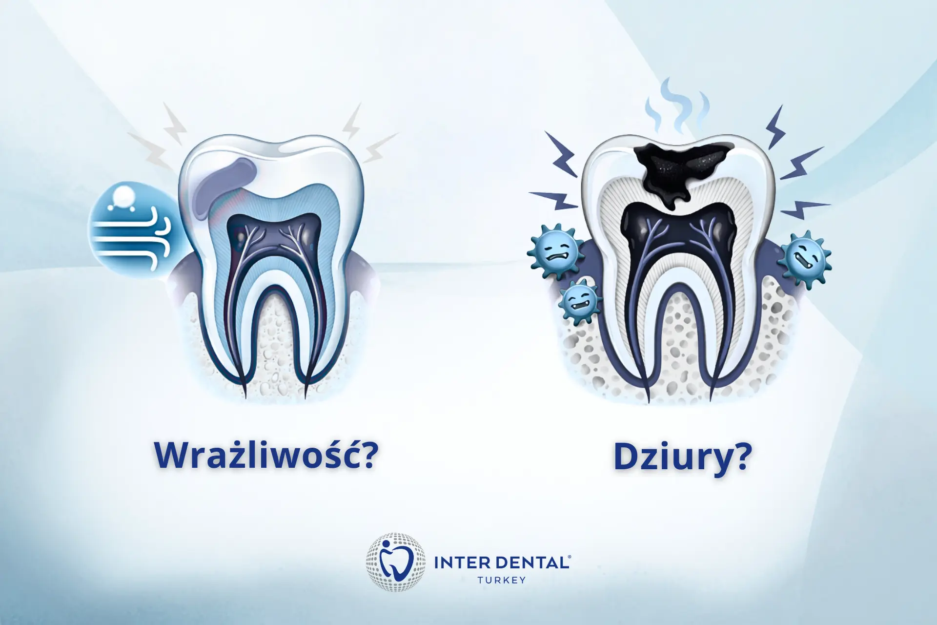 Nadwrażliwy ząb czy próchnica: ból na zimno i słodkie, ból utrzymujący się, ból przy nagryzaniu