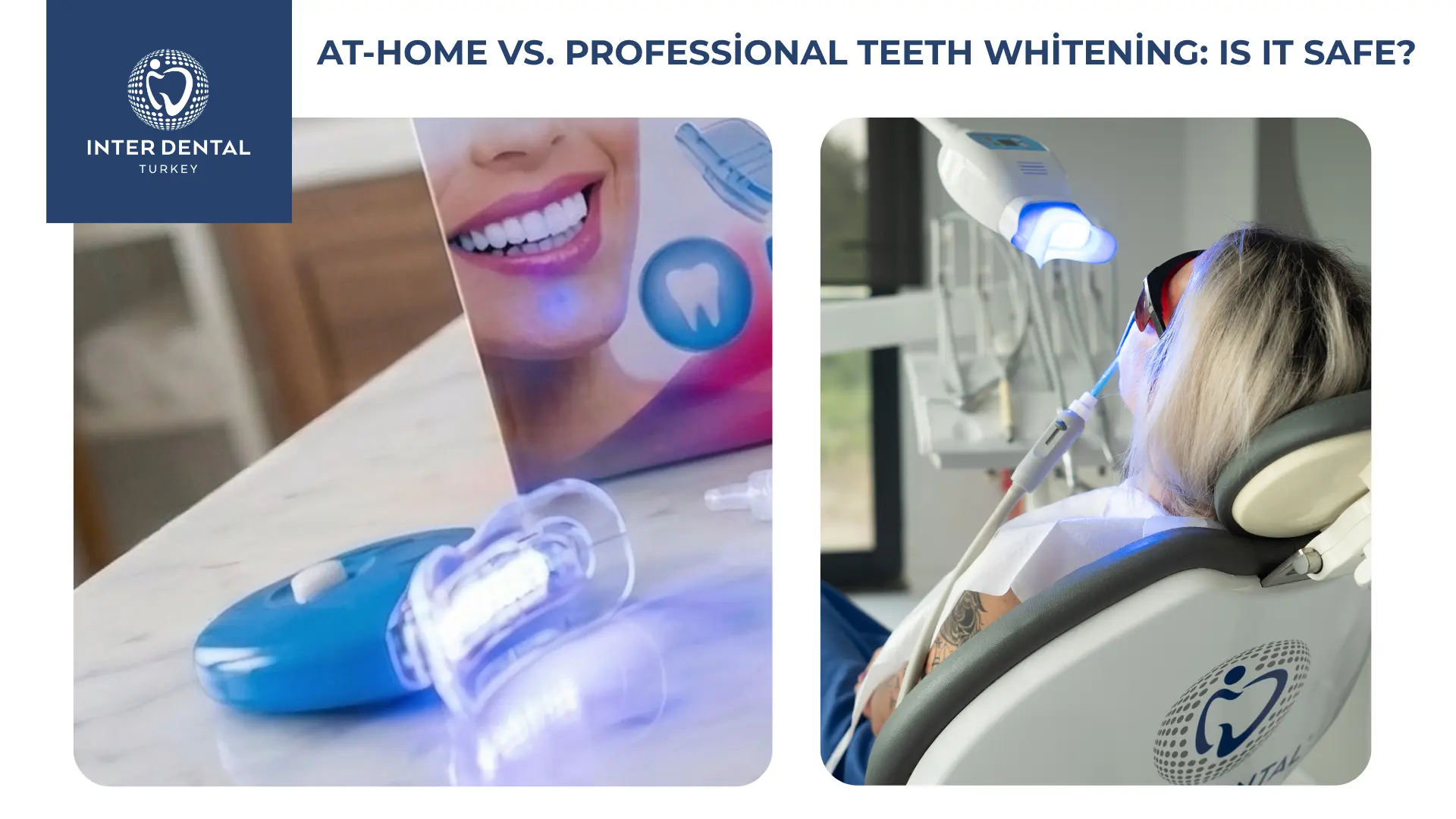 Comparison between at-home teeth whitening kits and professional clinic bleaching